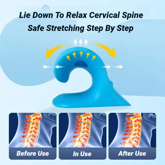 Neck Shoulder Relaxer Cervical Spine